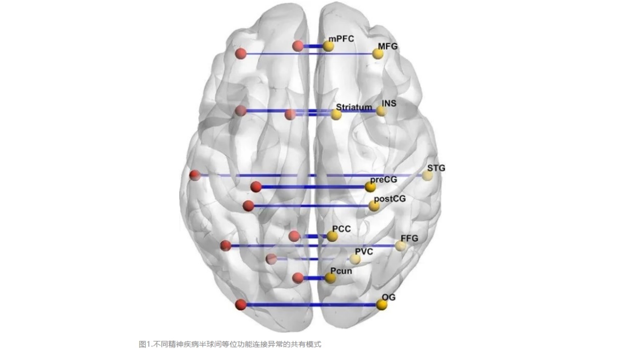 Rmpfc 精神疾病患者大脑半球间等位脑区功能连接的异常模式_颅脑损伤